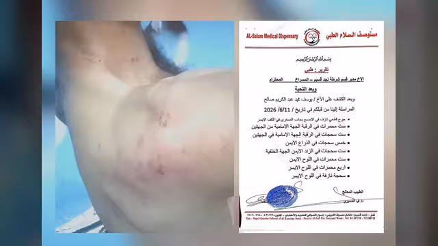 عندما يشتوي الغريب بنار القهر في جمهورية المسراخ..!