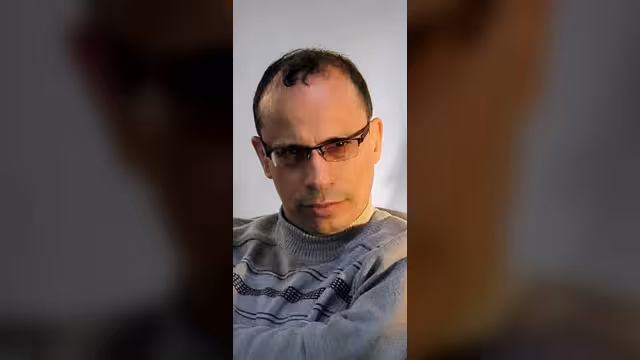 محمد الكميم.. عندما ينضج الفكر مبكرًا وتشرق العبقرية في غير سياقها