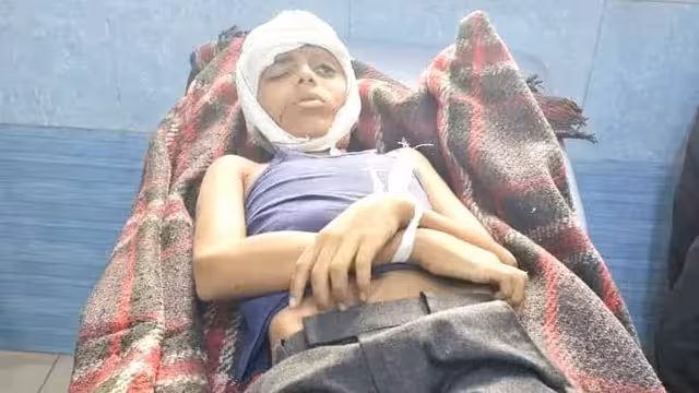 تعز: مقـ.تل طفل وإصابة امرأة بقصف حـ..وثي على منزل بمديرية صالة