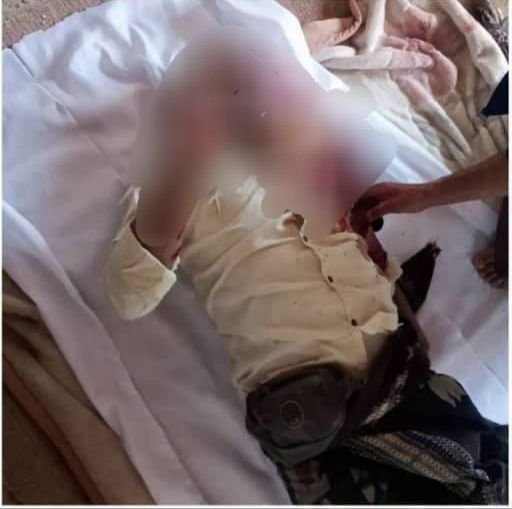 رجل ضحية القصف