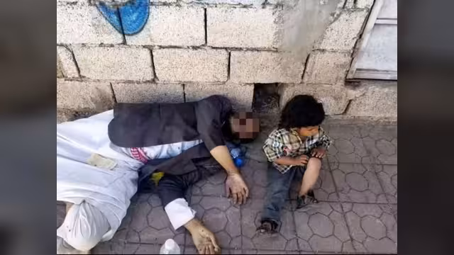 الطفولة في اليمن: مأساة مستمرة وقصص تدمي القلوب