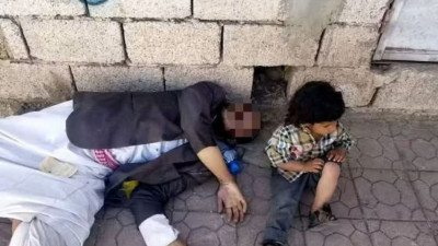 الطفولة في اليمن: مأساة مستمرة وقصص تدمي القلوب