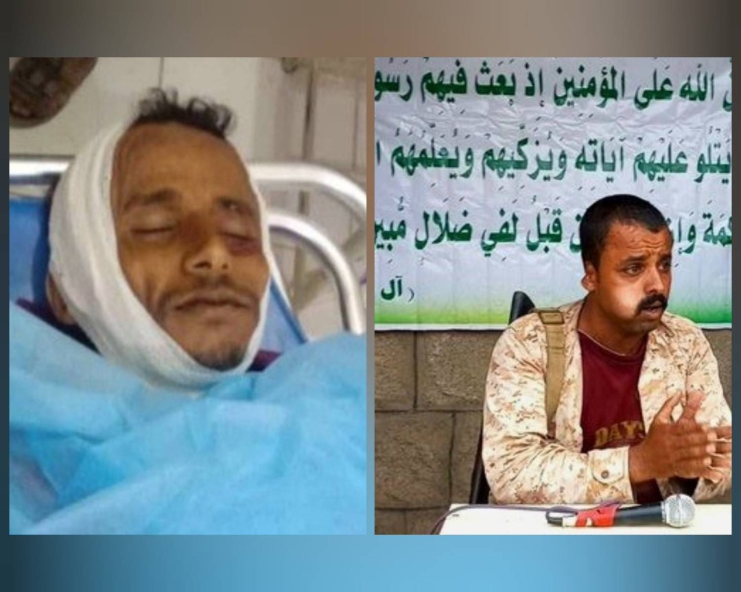 القيادي الحوثي أحمد عبده والمواطن فيصل علي 