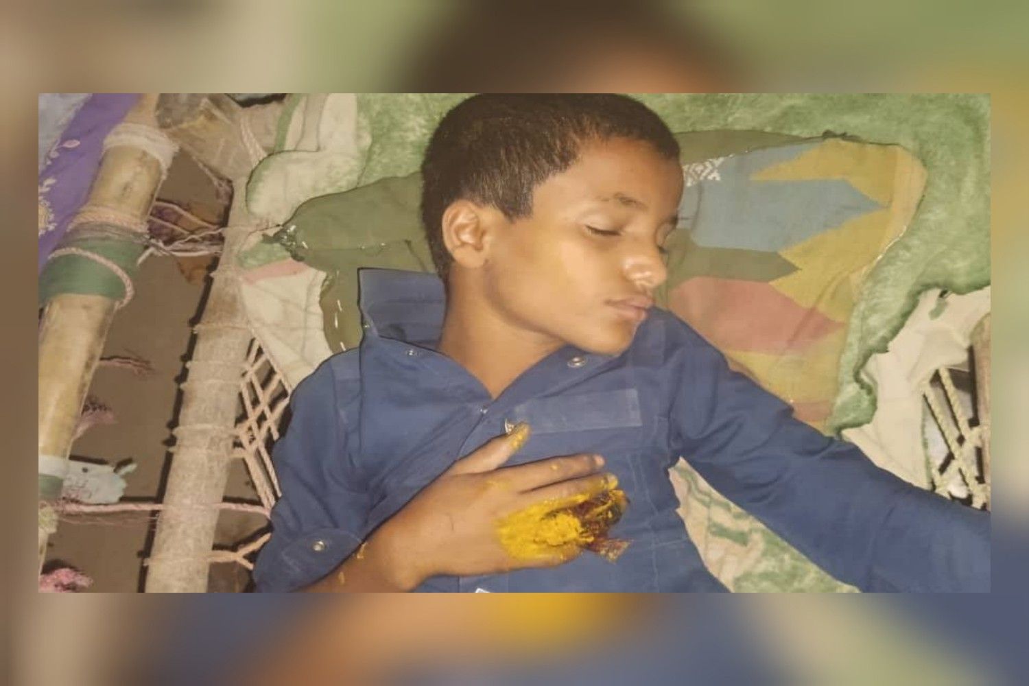 عنف مدرسي في حجة.. تلميذ يخرج مصاباً وإدارة التربية تلوذ بالصمت