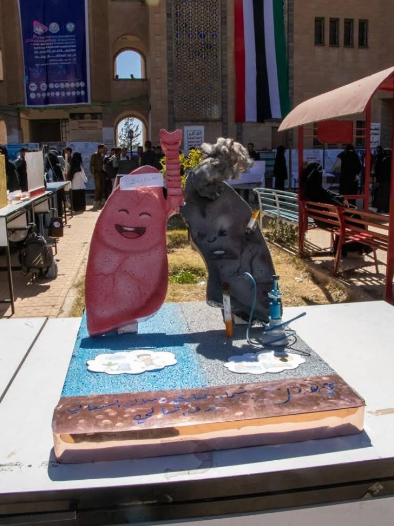 مجسم للرئة مجسم للرئة