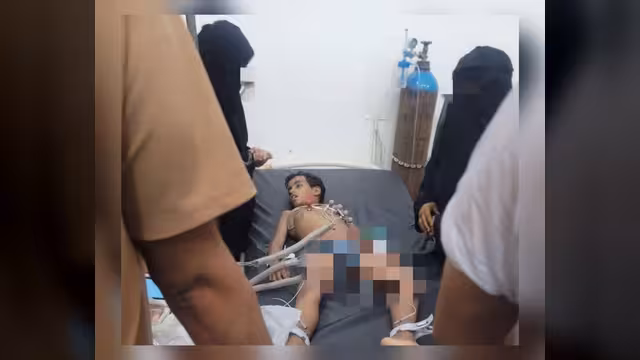 تعز: وفاة طفل ثانٍ جراء سيول الأمطار بعد ساعات من حادثة مماثلة