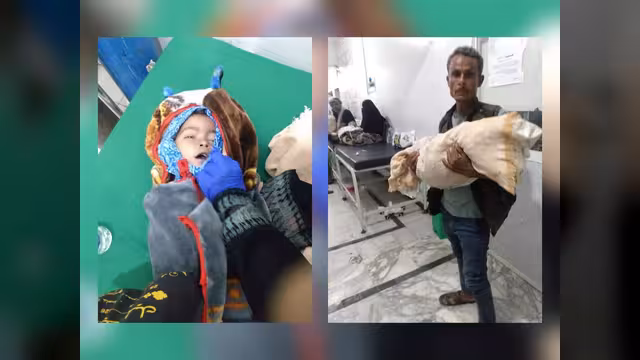 “30 ألف ريال” الفارق بين الحياة والموت لطفلة في مستشفى بتعز