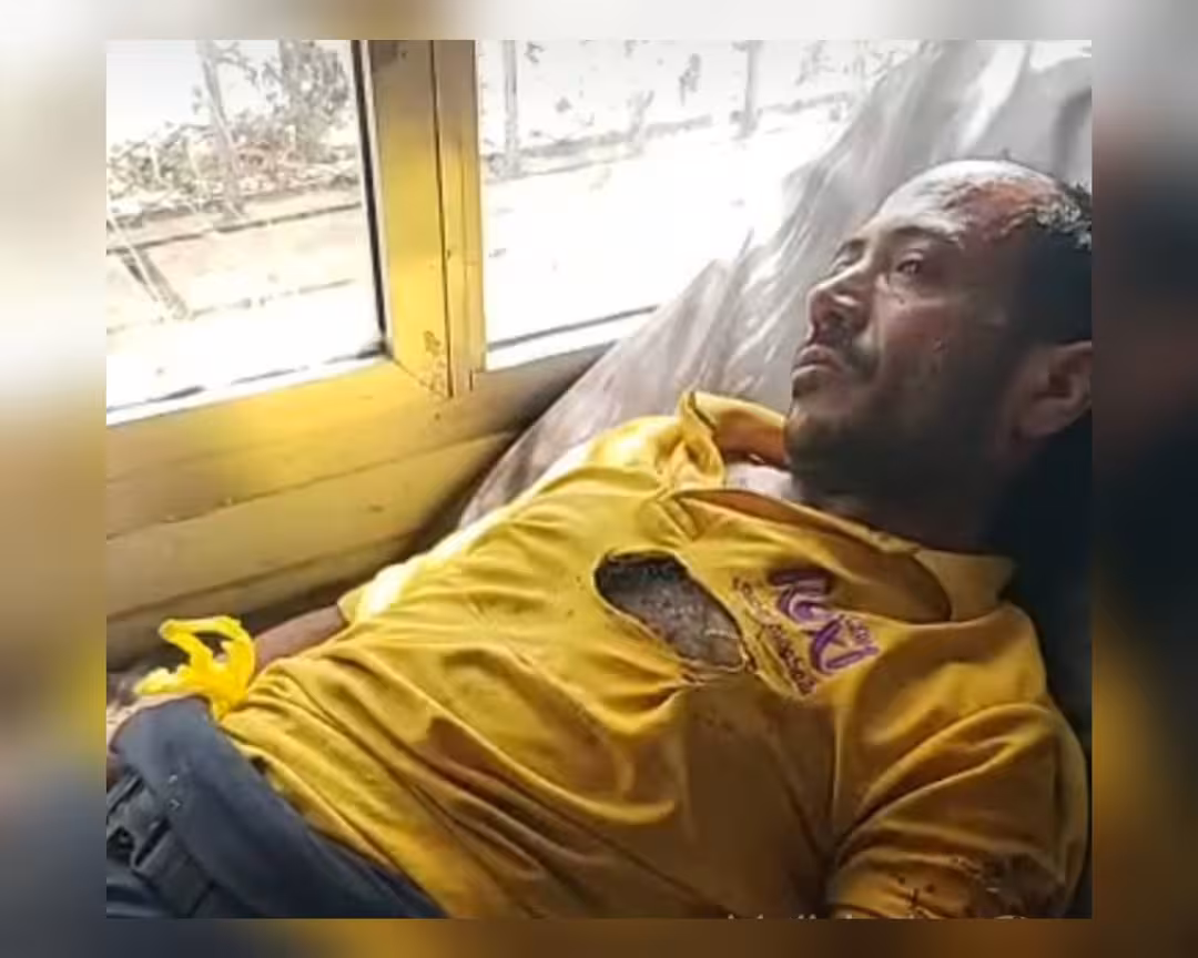 تعز: بائع متجول يحرق نفسه في سوق التربة احتجاجاً على الجبايات