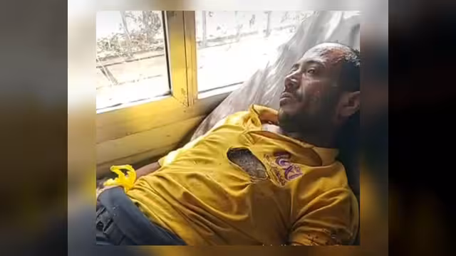 تعز: بائع متجول يحرق نفسه في سوق التربة احتجاجاً على الجبايات
